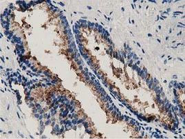 ANXA3 Antibody in Immunohistochemistry (Paraffin) (IHC (P))