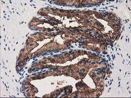 ANXA3 Antibody in Immunohistochemistry (Paraffin) (IHC (P))