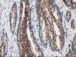 ANXA3 Antibody in Immunohistochemistry (Paraffin) (IHC (P))