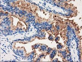 ANXA3 Antibody in Immunohistochemistry (Paraffin) (IHC (P))