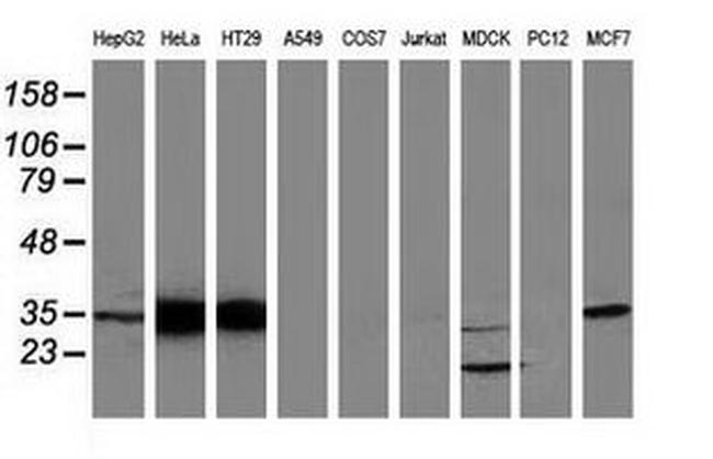 ANXA3 Antibody in Western Blot (WB)