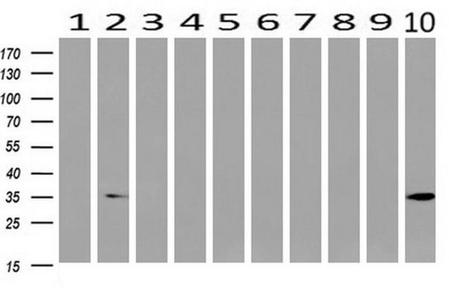 ANXA3 Antibody in Western Blot (WB)