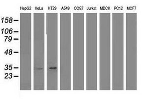 ANXA3 Antibody in Western Blot (WB)