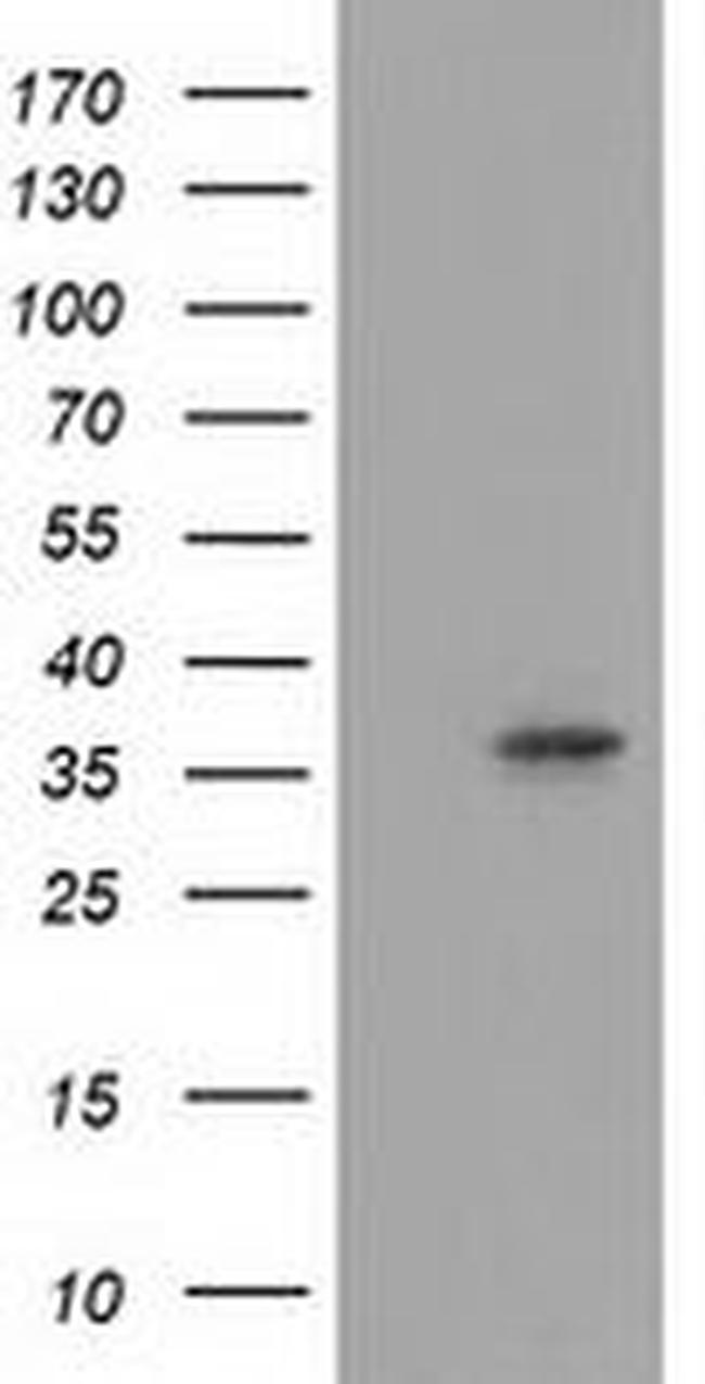 ANXA3 Antibody in Western Blot (WB)