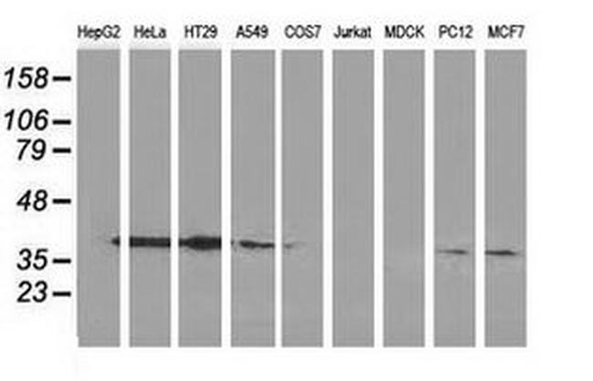 ANXA3 Antibody in Western Blot (WB)