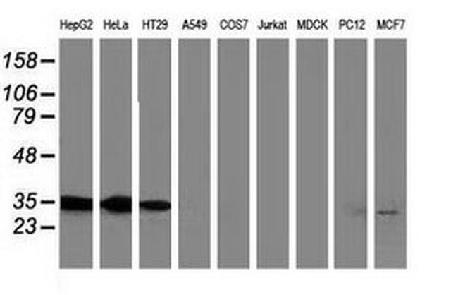 ANXA3 Antibody in Western Blot (WB)