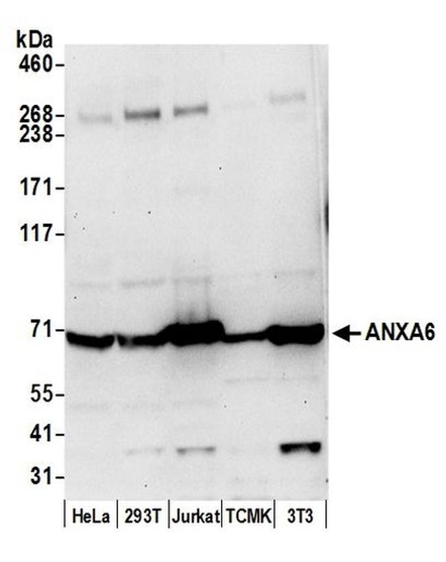 ANXA6 Antibody in Western Blot (WB)