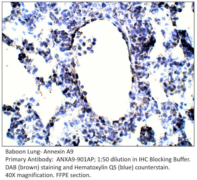 Annexin A9 Antibody in Immunohistochemistry (IHC)