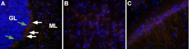 Orexin Receptor 2 Antibody in Immunohistochemistry (IHC)