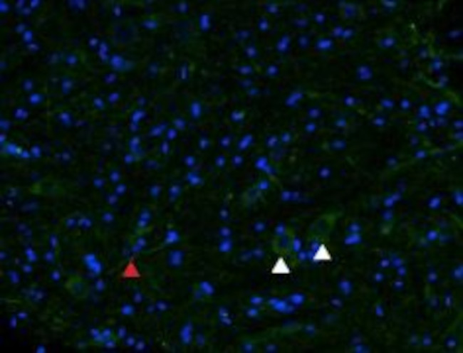 mu-Opioid Receptor (OPRM1) (extracellular) Antibody in Immunohistochemistry (Frozen) (IHC (F))