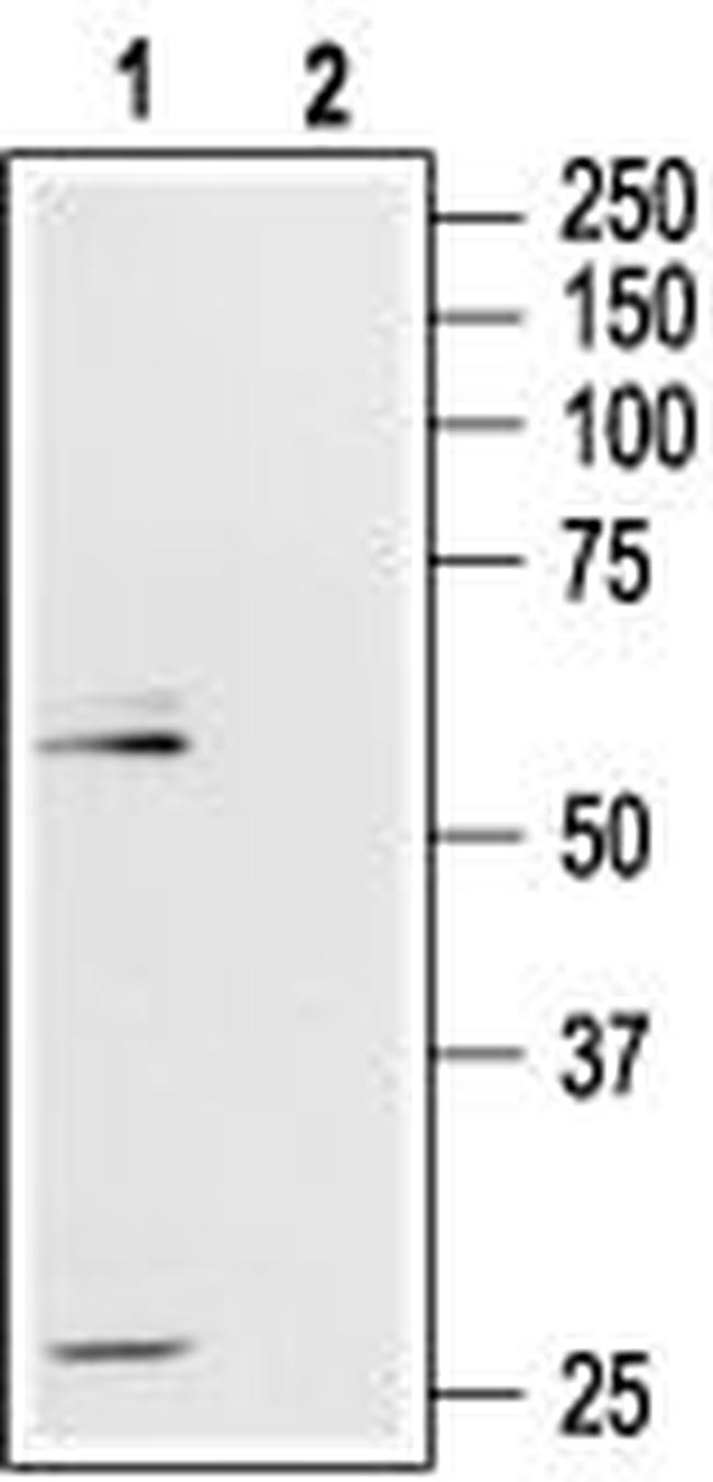 mu-Opioid Receptor (OPRM1) (extracellular) Antibody in Western Blot (WB)