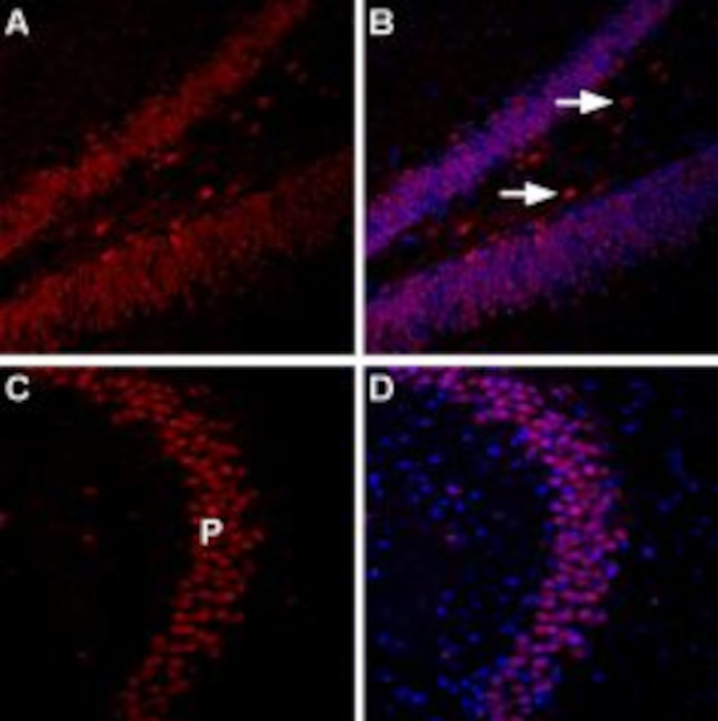 Nociceptin Receptor (OPRL1) Antibody in Immunohistochemistry (IHC)