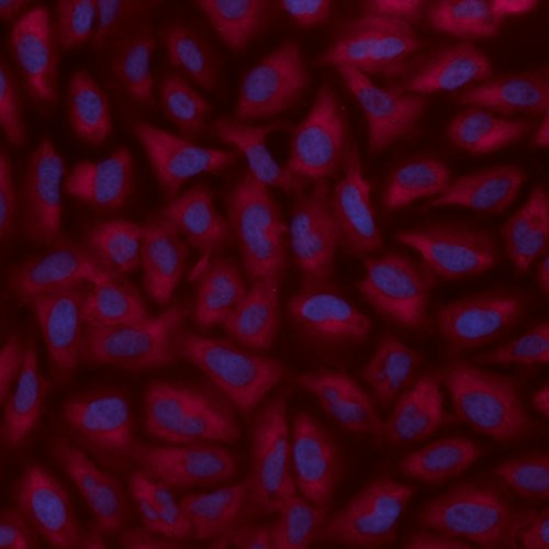 alpha Adaptin Antibody in Immunocytochemistry (ICC/IF)