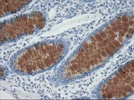 AP2M1 Antibody in Immunohistochemistry (Paraffin) (IHC (P))