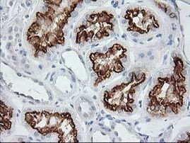 AP2M1 Antibody in Immunohistochemistry (Paraffin) (IHC (P))