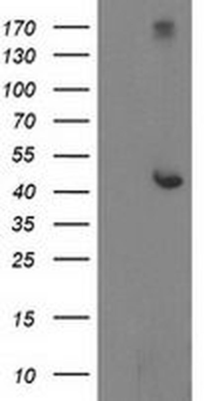 AP2M1 Antibody in Western Blot (WB)