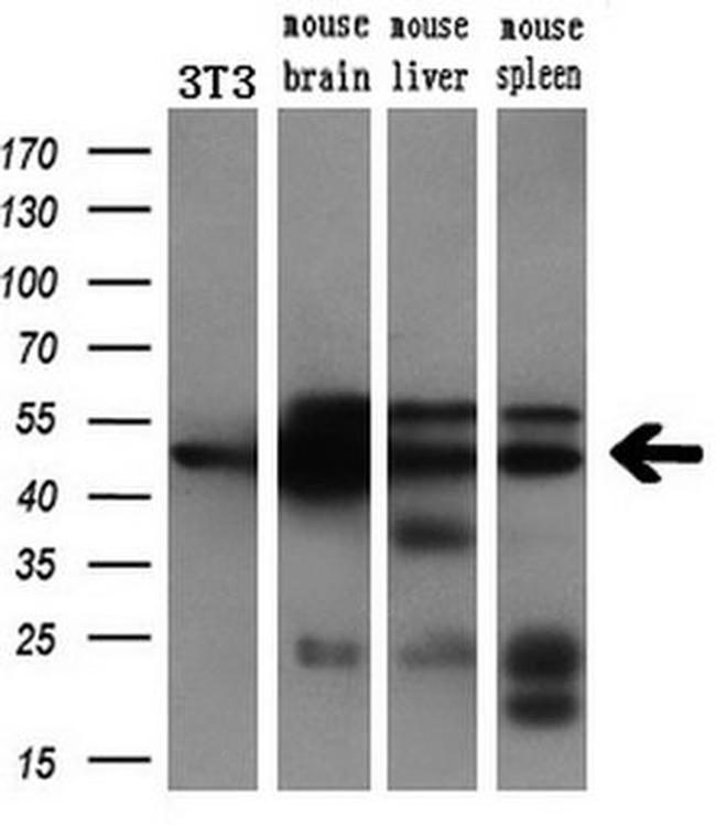 AP2M1 Antibody in Western Blot (WB)