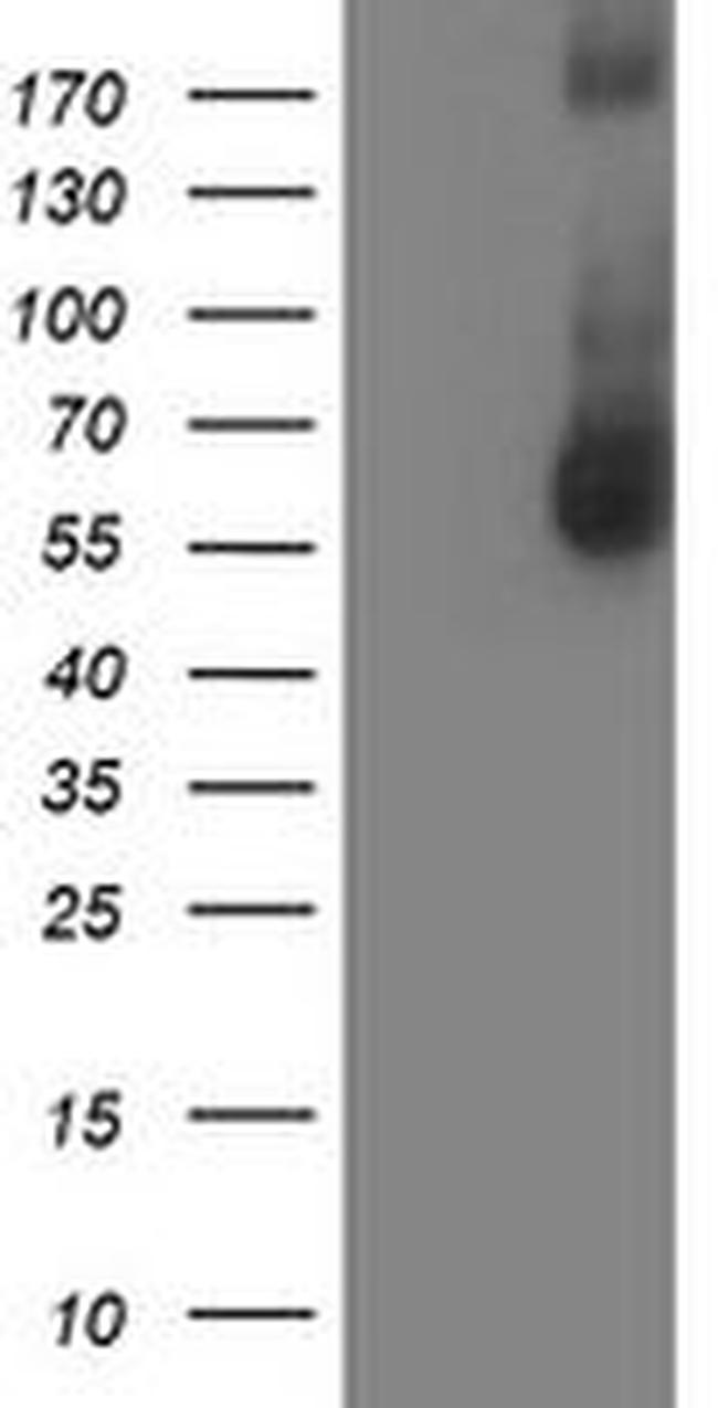 AP2M1 Antibody in Western Blot (WB)