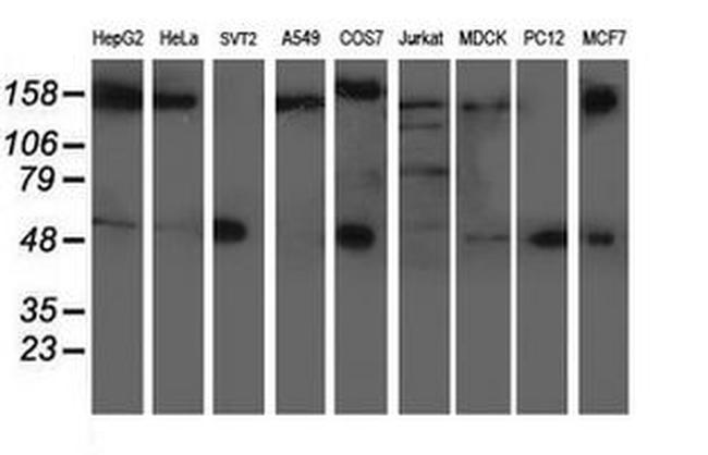 AP2M1 Antibody in Western Blot (WB)