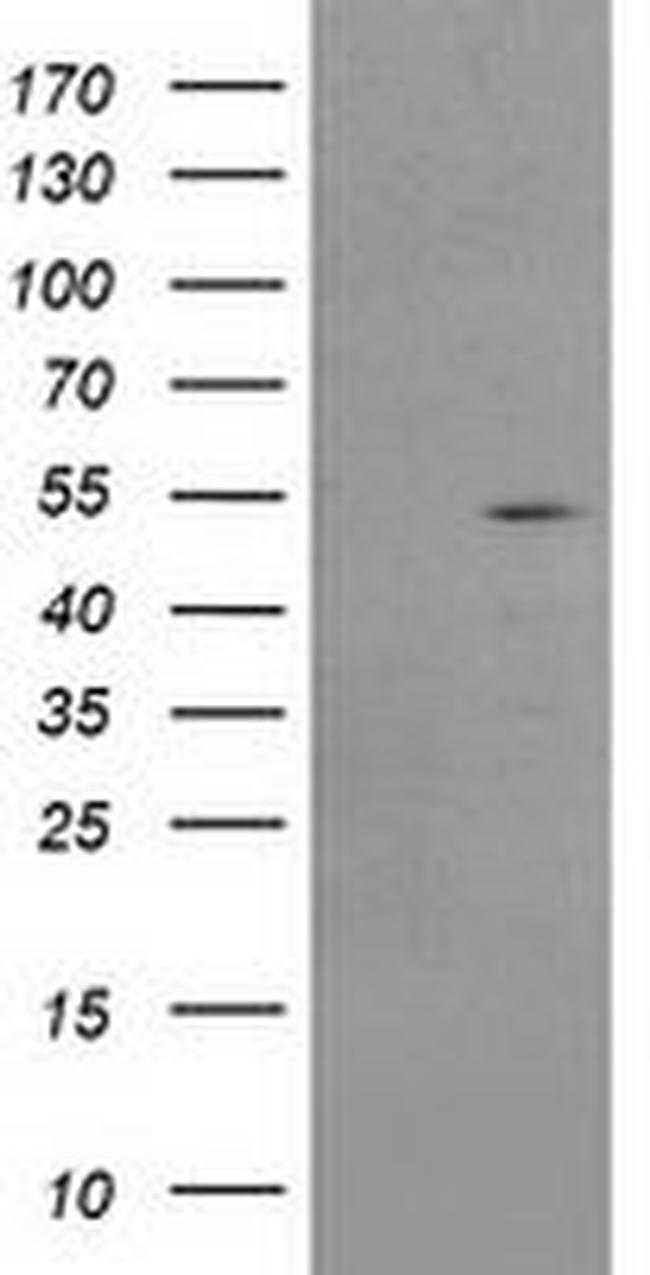 AP2M1 Antibody in Western Blot (WB)