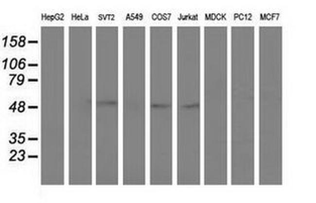 AP2M1 Antibody in Western Blot (WB)