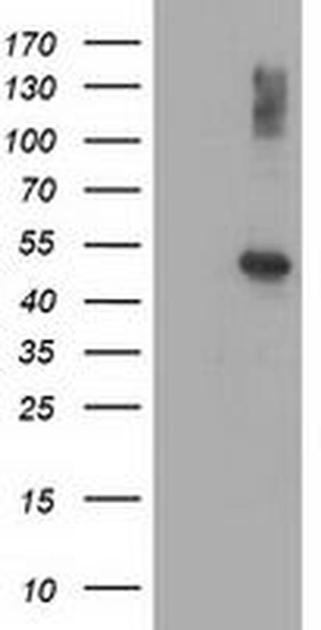 AP2M1 Antibody in Western Blot (WB)