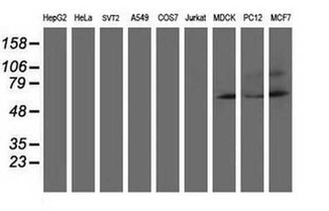 AP2M1 Antibody in Western Blot (WB)