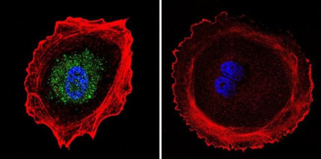 AP2 alpha Antibody in Immunocytochemistry (ICC/IF)