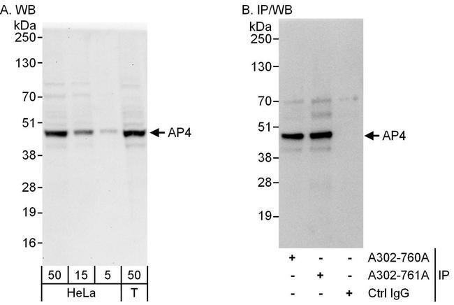 AP4 Antibody in Western Blot (WB)