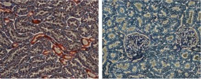 KCNJ1 (Kir1.1) Antibody in Immunohistochemistry (IHC)