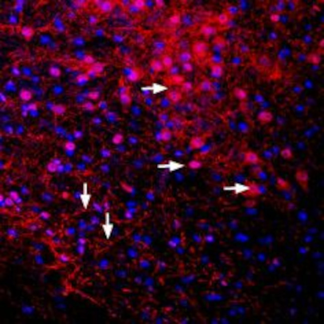 GIRK2 (Kir3.2) Antibody in Immunohistochemistry (Frozen) (IHC (F))