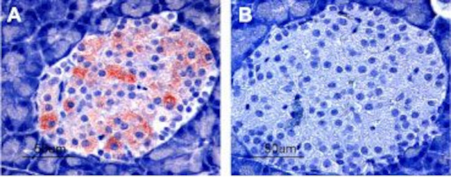 Kir6.2 Antibody in Immunohistochemistry (IHC)