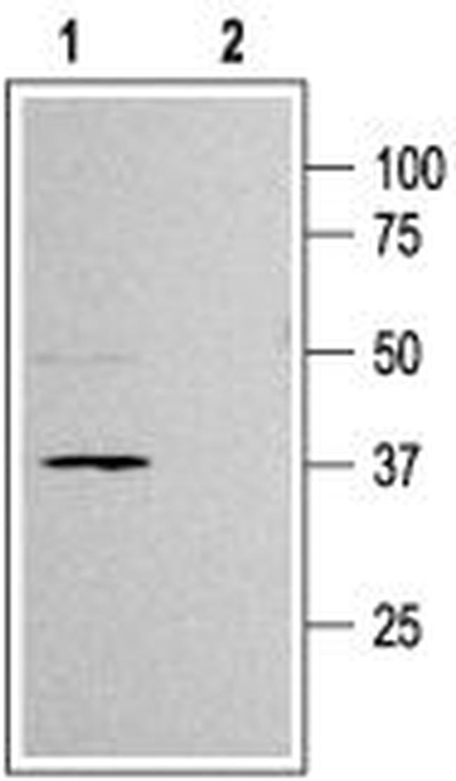 Kir6.2 Antibody in Western Blot (WB)