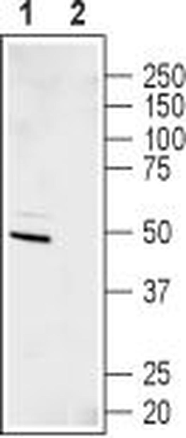 Kir6.2 Antibody in Western Blot (WB)