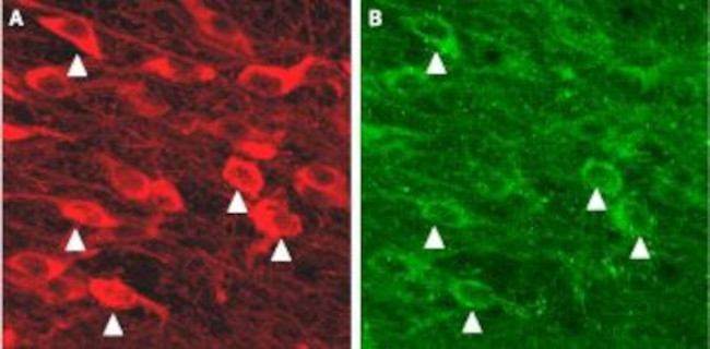 KCNN3 (KCa2.3, SK3) Antibody in Immunohistochemistry (IHC)