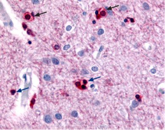 KCNN2 (KCa2.2, SK2) Antibody in Immunohistochemistry (IHC)