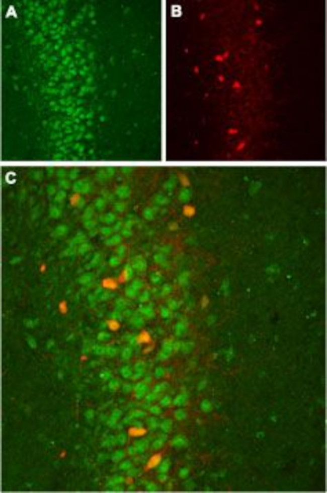 slo beta 2 (KCNMB2) Antibody in Immunohistochemistry (IHC)