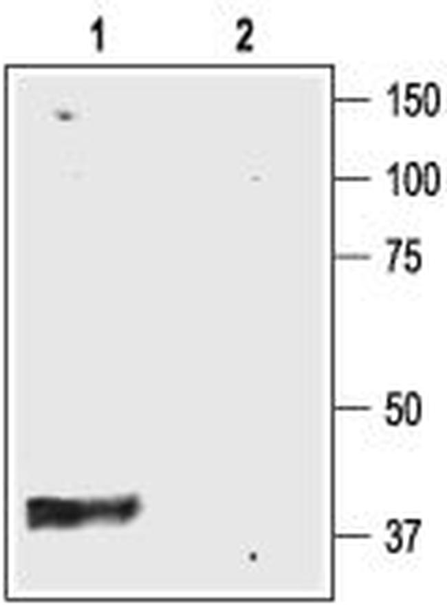 Kir4.1 (KCNJ10) Antibody in Western Blot (WB)