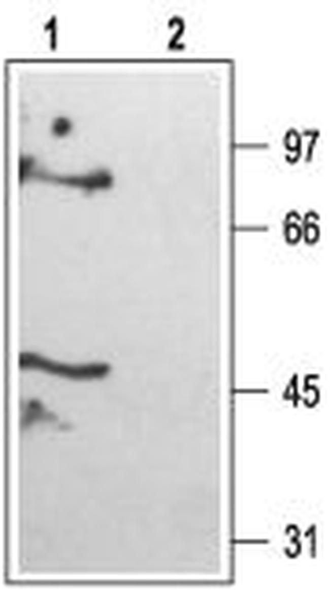 KCNK6 (TWIK-2) Antibody in Western Blot (WB)