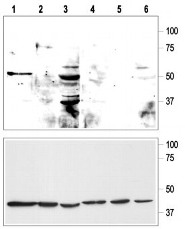 KCNK9 (TASK-3) (extracellular) Antibody in Western Blot (WB)