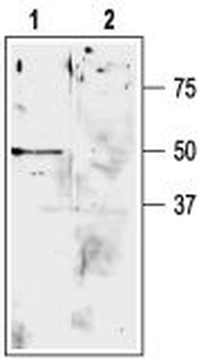 KCNK9 (TASK-3) (extracellular) Antibody in Western Blot (WB)