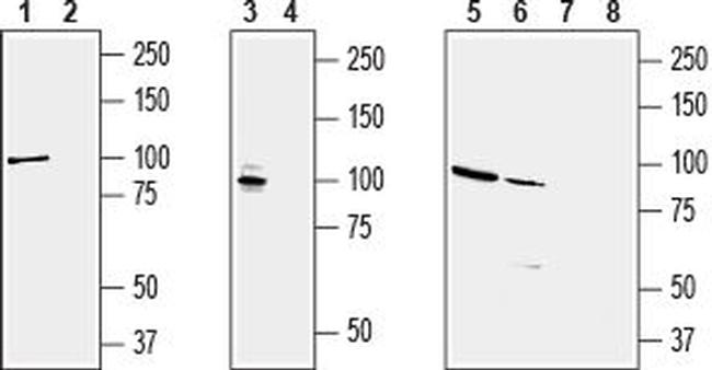 KCNQ2 Antibody in Western Blot (WB)