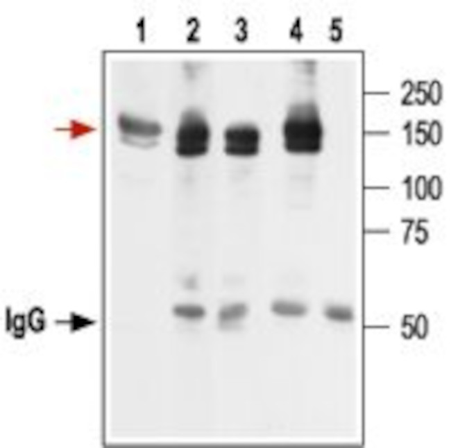 KCNH2 (HERG) Antibody in Immunoprecipitation (IP)