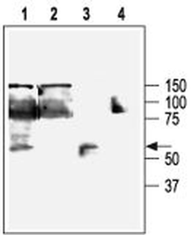 KCNN4 (KCa3.1, SK4) Antibody in Western Blot (WB)