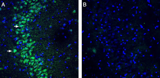 slo beta 3 (KCNMB3) (extracellular) Antibody in Immunohistochemistry (Frozen) (IHC (F))