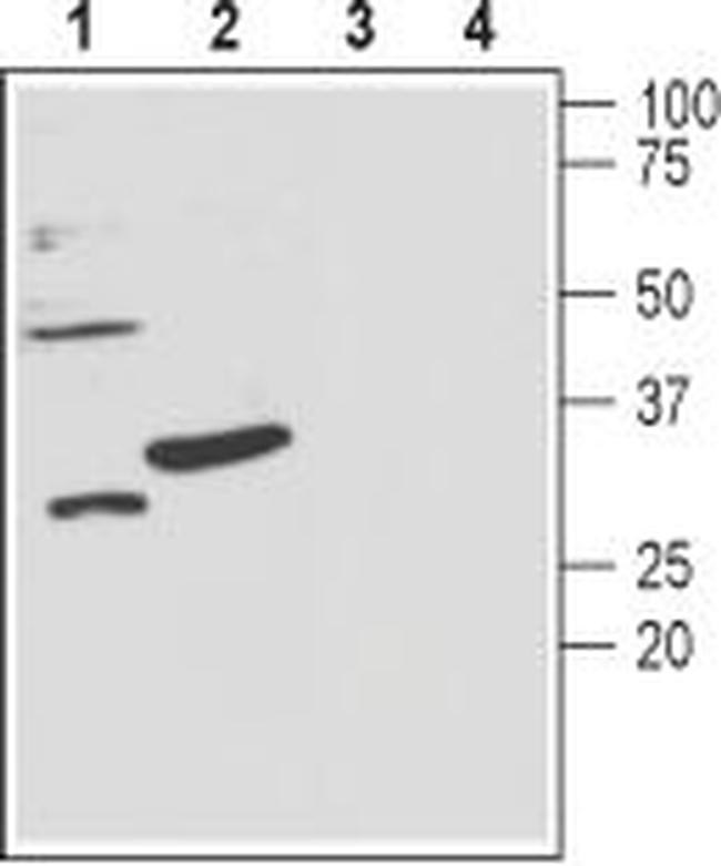 slo beta 3 (KCNMB3) (extracellular) Antibody in Western Blot (WB)