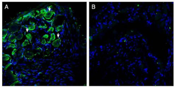 Piezo2 Antibody in Immunohistochemistry (Frozen) (IHC (F))