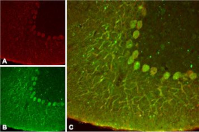 KCNK4(TRAAK) Antibody in Immunohistochemistry (IHC)