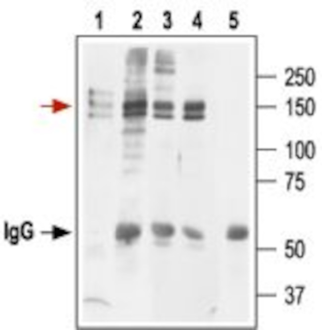 KCNH2 (HERG) (extracellular) Antibody in Immunoprecipitation (IP)