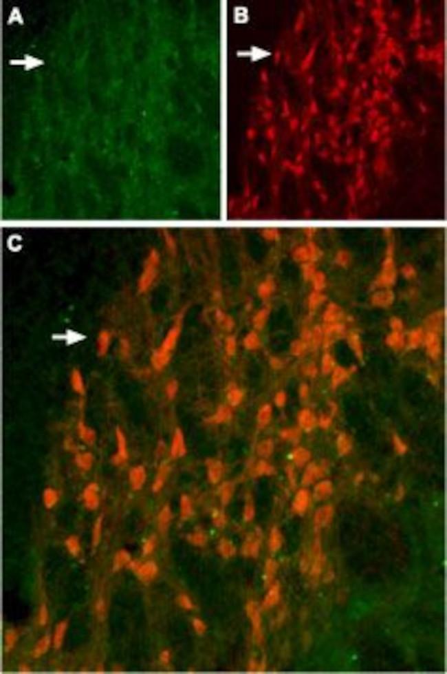 KCNH6 (erg2) Antibody in Immunohistochemistry (IHC)